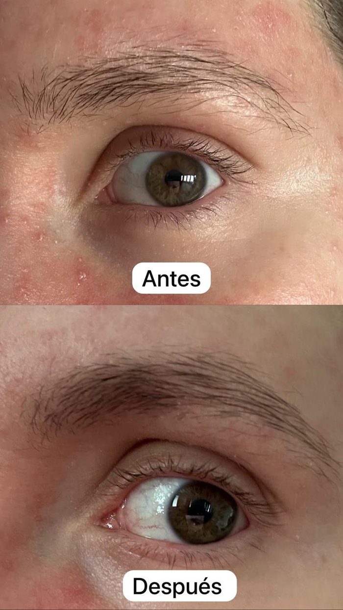Testimonio 1