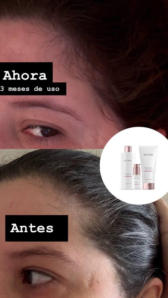 Testimonio 5